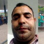 Mulher do Prefeito de Sarandi agride cidadão