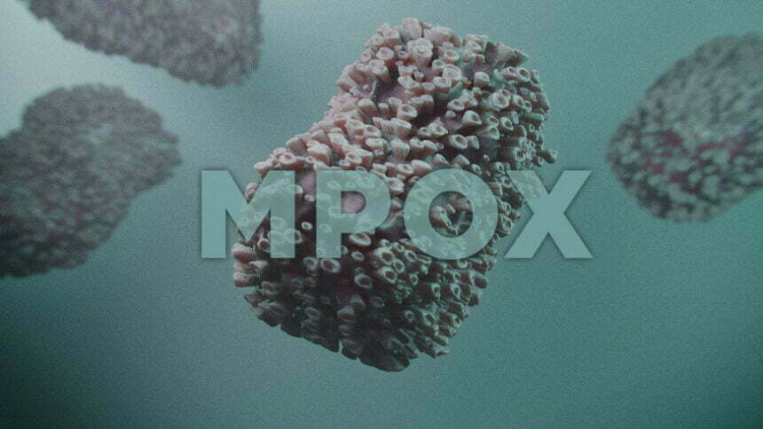 casos de Mpox