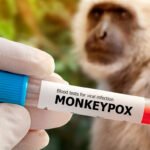 Monkeypox