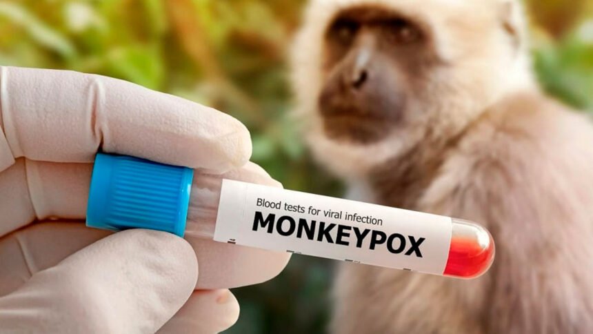 Monkeypox
