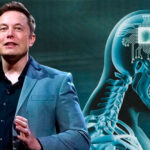 Neuralink empresa de implantes cerebrais de Elon Musk