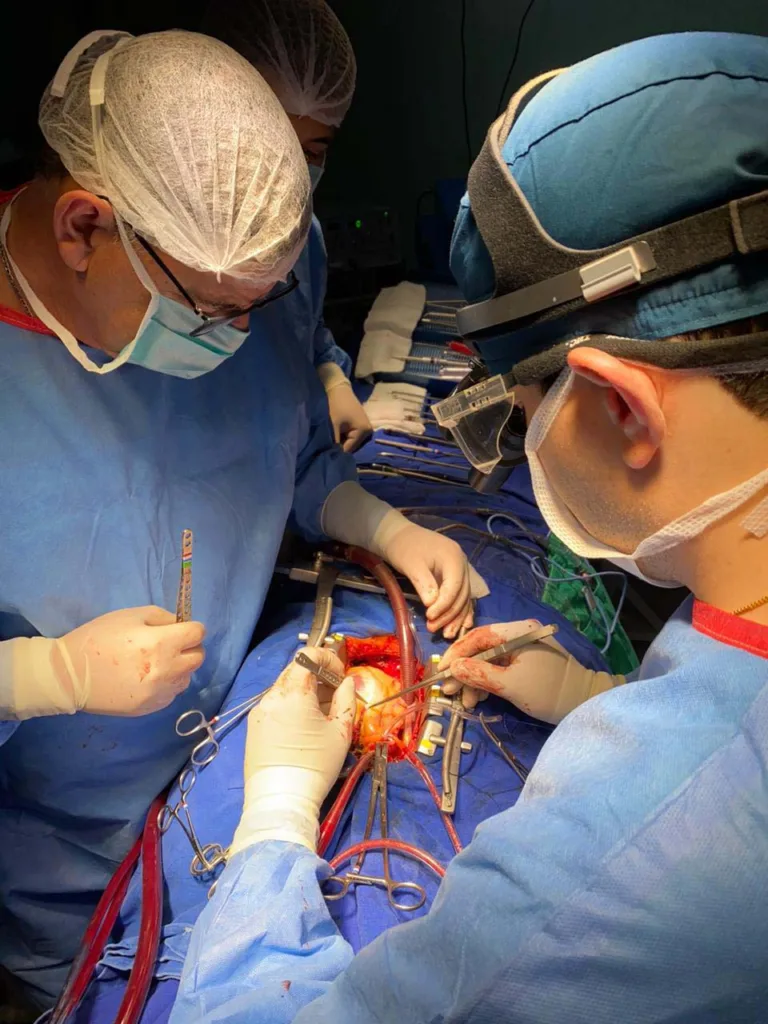 O Hospital Universitário do Oeste do Paraná, em Cascavel, realizou nesta sexta-feira (21) sua primeira cirurgia cardiovascular em mais de uma década. O procedimento marca o retorno da oferta deste atendimento que, até então, vinha sendo feito pelo Hospital Norte do Paraná, em Arapongas, fazendo com que pacientes tivessem que se deslocar mais de 300 km.

“Temos realizado grandes esforços para acolher pacientes que necessitam passar por cirurgias cardíacas. Esse é um marco importante, onde o Huop retorna a ser um ponto de referência para estes pacientes, garantindo também mais praticidade e conforto, evitando grandes deslocamentos”, avaliou o secretário de Estado da Saúde, César Neves.

Média mensal de cirurgias eletivas em 2024 está 43% maior do que a do ano passado
Nos últimos anos, o HUOP continuou realizando procedimentos não invasivos, como cateterismo e revascularização. Com a retomada das cirurgias invasivas, espera-se uma melhoria significativa na qualidade de vida dos pacientes, que antes enfrentavam o desgaste de esperar por transferências para locais distantes.

“O que retomamos hoje vai fazer a diferença na vida de muitas pessoas, principalmente pelo desgaste que era ter que esperar a transferência para longe de casa para a realização da cirurgia”, destaca o diretor-geral do hospital, Rafael Muniz de Oliveira.

O paciente operado está estável na UTI, conforme previsto após cirurgias cardíacas. A partir de agora, o HUOP planeja retomar gradualmente este tipo de cirurgia, com a previsão inicial de realizar duas operações por semana, aumentando para quatro por semana nos próximos meses.

MAIS AÇÕES - No último mês, o Estado também autorizou o aumento de recursos destinados ao Hospital São Lucas, em Cascavel, visando aprimorar os serviços de cardiologia de alta complexidade na região. O repasse mensal para custeio de procedimentos passou de R$ 1,1 milhão para R$ 4,1 milhões, representando um crescimento de 270%.

Saúde remaneja vacinas da dengue próximas do vencimento para otimizar uso
“Estamos monitorando os serviços ofertados e garantindo que todos os pacientes sejam tratados com excelência. O governador sempre reforçou a importância de levar a saúde até as pessoas e essas novas perspectivas para estes hospitais vão nesse caminho”, finalizou o secretário.