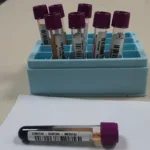Solidariedade: Paraná tem o 3º maior cadastro de doadores de medula óssea do Brasil