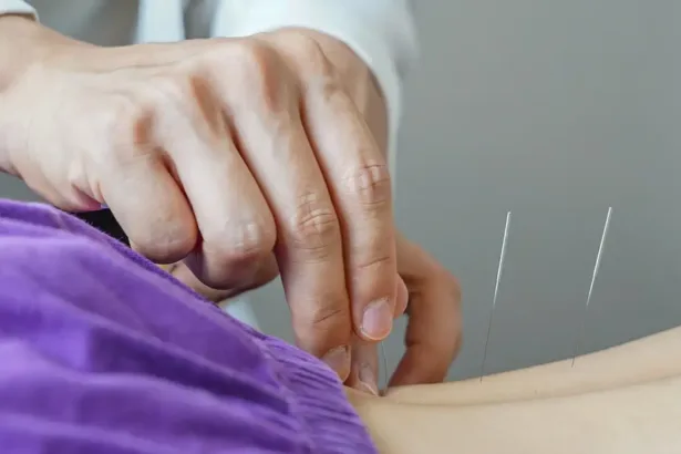 Brasil regulamenta exercício profissional da acupuntura